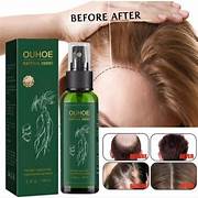 OUHOE Hair Growth Spray