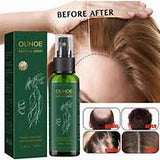 OUHOE Hair Growth Spray